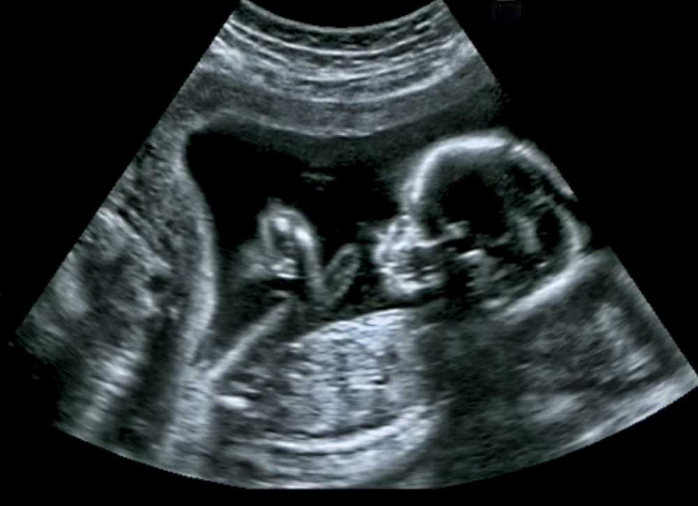 picture of Ultrasound